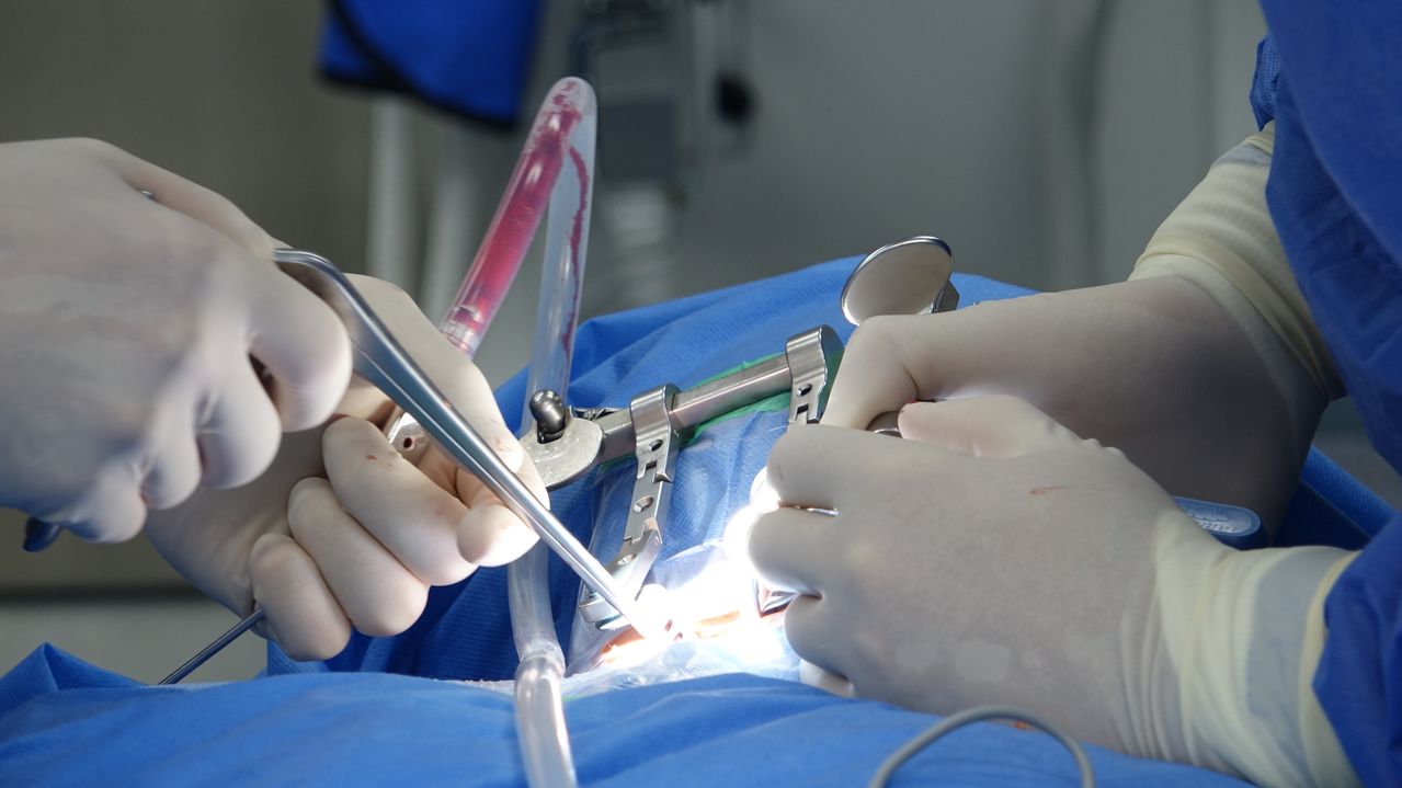 Riabilitazione ginocchio